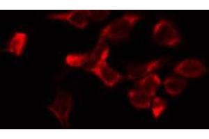 ABIN6274547 staining HeLa by IF/ICC. (JIP3 anticorps  (Internal Region))