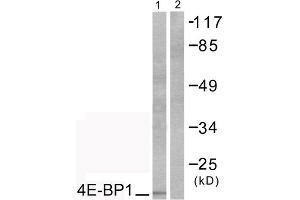 Western blot analysis of extracts from COS7 cells, treated with EGF (200ng/ml, 30mins), using 4E-BP1 (epitope around residue 69) antibody (ABIN5976164). (eIF4EBP1 anticorps  (Thr70))