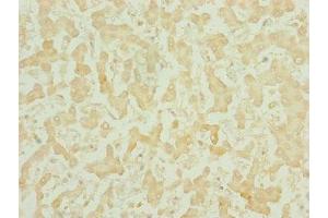 Immunohistochemistry of paraffin-embedded human liver tissue using ABIN7159686 at dilution of 1:100