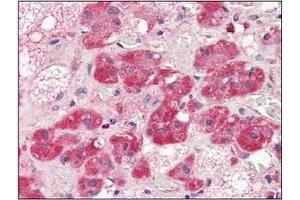 Immunohistochemistry (IHC) image for anti-5'-Nucleotidase, Ecto (CD73) (NT5E) (AA 27-252) antibody (ABIN238367)