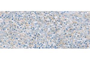 Immunohistochemistry of paraffin-embedded Human tonsil tissue using PYCR2 Polyclonal Antibody at dilution of 1:40(x200)