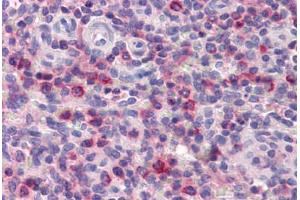 Human Spleen (formalin-fixed, paraffin-embedded) stained with ONECUT1 antibody ABIN462211 followed by biotinylated goat anti-rabbit IgG secondary antibody ABIN481713, alkaline phosphatase-streptavidin and chromogen. (ONECUT1 anticorps  (C-Term))