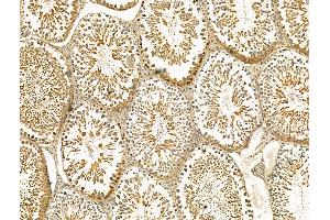 ABIN7094437 and ABIN7098485 at 1/100 staining Rat testis tissue by IHC-P.