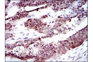 Immunohistochemistry (IHC) image for anti-Cytochrome P450, Family 1, Subfamily A, Polypeptide 1 (CYP1A1) antibody (ABIN1846449)