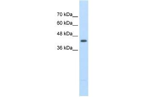 WB Suggested Anti-UPB1 Antibody Titration:  2. (UPB1 anticorps  (Middle Region))