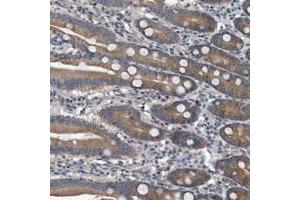Immunohistochemical staining of human duodenum with FAM136A polyclonal antibody  shows moderate cytoplasmic positivity in glandular cells at 1:200-1:500 dilution. (FAM136A anticorps)