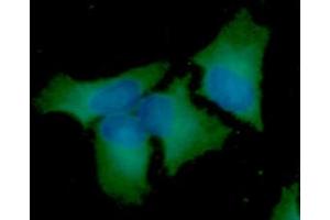 ICC/IF analysis of BECN1 in HeLa cells line, stained with DAPI (Blue) for nucleus staining and monoclonal anti-human BECN1 antibody (1:100) with goat anti-mouse IgG-Alexa fluor 488 conjugate (Green).