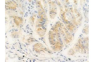 ABIN6256675 and ABIN6267240 at 1/100 staining human normal gastric tissue by IHC-P. (JAK2 anticorps  (pTyr221))