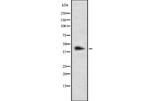 Western blot analysis of LHX3 using HepG2 whole cell lysates (LHX3 anticorps  (C-Term))