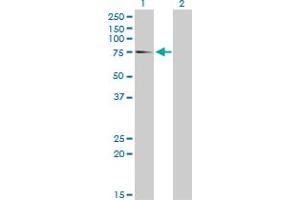 Western Blot analysis of EIF4G1 expression in transfected 293T cell line by EIF4G1 monoclonal antibody (M10), clone 2A9.
