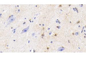 Detection of S100 in Bovine Cerebellum Tissue using Polyclonal Antibody to S100 Calcium Binding Protein (S100)