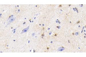 Detection of S100 in Bovine Cerebellum Tissue using Polyclonal Antibody to S100 Calcium Binding Protein (S100) (S100 Protein (S100) (AA 1-94) anticorps)