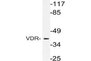 Western blot (WB) analysis of VDR antibody in extracts from Jurkat cells. (Vitamin D Receptor anticorps)