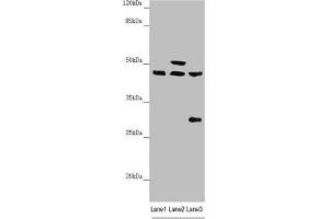 Western blot All lanes: HAUS8 antibody at 2. (NYS48/HAUS8 anticorps  (AA 166-410))