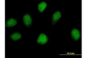 Immunofluorescence of purified MaxPab antibody to MGC16943 on HeLa cell. (ERI2 anticorps  (AA 1-328))