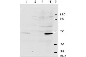 Western-Blot analysis of HPV-11 E2 protein. (Human Papilloma Virus 11 E2 (HPV-11 E2) (AA 202-284) anticorps)