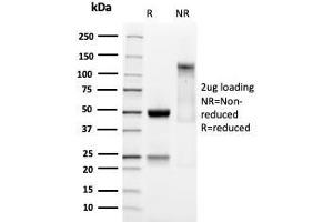 SDS-PAGE Analysis Purified SOX9 Recombinant Rabbit Monoclonal Antibody (SOX9/3141R).