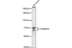 Western blot analysis of extracts of Rat brain, using HNRNPM antibody (ABIN7267635) at 1:1000 dilution.