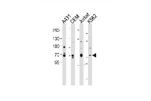 Western blot analysis of lysates from A431, CEM, Jurkat, K562 cell line (from left to right), using ITK Antibody (Center) (ABIN6243870 and ABIN6577737). (ITK anticorps  (AA 228-262))