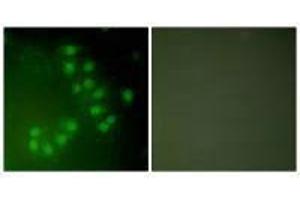 Immunofluorescence analysis of A549 cells, using p63 antibody. (p63 anticorps)