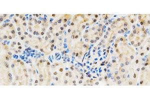 Immunohistochemistry of paraffin-embedded Mouse kidney using LGALS3 Polyclonal Antibody at dilution of 1:200 (40x lens).