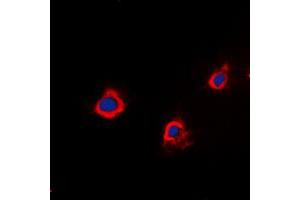 Immunofluorescent analysis of PTTG1IP staining in A549 cells. (PTTG1IP anticorps  (Center))