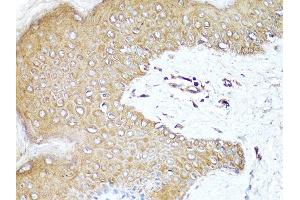 Immunohistochemistry of paraffin-embedded human skin using PDCD1 antibody (ABIN6290170) at dilution of 1:100 (40x lens).