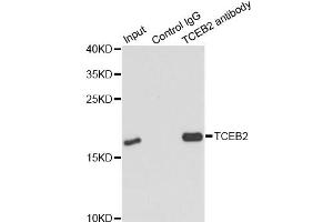 Immunoprecipitation analysis of 150ug extracts of MCF7 cells using 3ug TCEB2 antibody (ABIN6292903). (TCEB2 anticorps)
