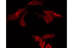 ABIN6275747 staining Hela by IF/ICC. (TAO Kinase 3 anticorps  (Internal Region))