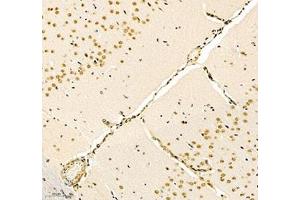 Immunohistochemistry of paraffin embedded mouse brain using notch3 (ABIN7074862) at dilution of 1:700 (200x lens)