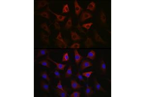 Immunofluorescence analysis of NIH/3T3 cells using GAPDH Mouse mAb (ABIN3020540, ABIN3020541, ABIN3020542 and ABIN1512934) at dilution of 1:100 (40x lens). (GAPDH anticorps)