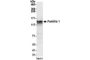 Western Blotting (WB) image for anti-Pumilio Homolog 1 (PUM1) (AA 225-275) antibody (ABIN7450619) (PUM1 anticorps  (AA 225-275))