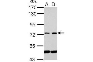 WB Image Sample (30 ug of whole cell lysate) A: Jurkat B: Raji 7. (GLMN anticorps)