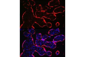 Immunofluorescence analysis of human placenta using HSD3B1 Rabbit pAb (ABIN6131041, ABIN6142016, ABIN6142017 and ABIN6224059) at dilution of 1:100 (40x lens).
