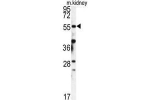 Western blot analysis of FKBP9 antibody (N-term) in mouse kidney tissue lysates (35 µg/lane). (FKBP9 anticorps  (N-Term))
