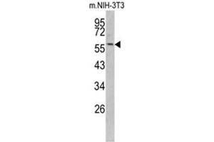 Western blot analysis of KRT14 antibody (Center) in NIH-3T3 cell line lysates (35ug/lane). (KRT14 anticorps  (Middle Region))