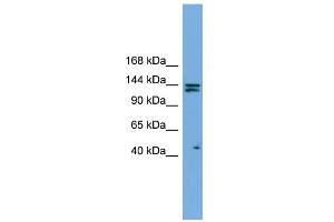 WB Suggested Anti-IARS Antibody Titration: 0. (IARS anticorps  (Middle Region))