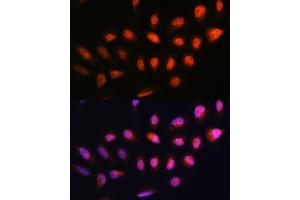 Immunofluorescence analysis of U2OS cells using NPLOC4 Rabbit pAb (ABIN1681086, ABIN5664262, ABIN5664264 and ABIN6220175) at dilution of 1:100. (NPLOC4 anticorps  (AA 1-270))