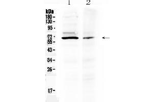 Western blot analysis of AMH using anti- AMH antibody . (AMH anticorps  (AA 75-141))