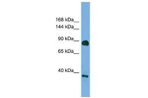 WB Suggested Anti-DLG4 Antibody Titration: 0. (DLG4 anticorps  (Middle Region))