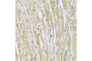Immunohistochemistry of paraffin-embedded mouse heart using B antibody (ABIN7265851) at dilution of 1:100 (40x lens). (BAG3 anticorps  (AA 380-575))