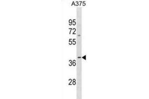 Western Blotting (WB) image for anti-Olfactory Receptor, Family 13, Subfamily D, Member 1 (OR13D1) antibody (ABIN3001031) (OR13D1 anticorps)