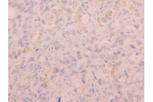 IHC-P analysis of Human Ovary Tissue, with DAB staining. (CD5L anticorps  (AA 133-256))