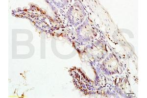 Formalin-fixed and paraffin embedded rat colon labeled with Rabbit Anti ERK1/MAPK3 Polyclonal Antibody, Unconjugated (ABIN736476) at 1:200 followed by conjugation to the secondary antibody and DAB staining