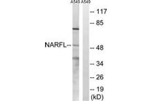 Western Blotting (WB) image for anti-Nuclear Prelamin A Recognition Factor-Like (NARFL) (AA 387-436) antibody (ABIN2890471) (NARFL anticorps  (AA 387-436))