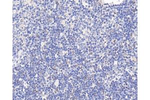 Immunohistochemistry analysis of paraffin-embedded rat thymus using CCR5 Polyclonal Antibody at dilution of 1:300. (CCR5 anticorps)