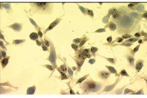 Hsp70 Mouse Melanoma Cells Immunohistochemistry of Mouse anti-Hsp70 monoclonal antibody.