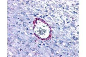 Anti-HRH1 / Histamine H1 Receptor antibody IHC of human Vessel.