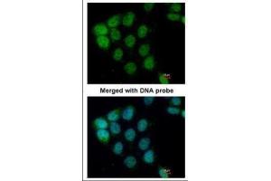 ICC/IF Image Immunofluorescence analysis of paraformaldehyde-fixed A431, using ARAF, antibody at 1:200 dilution.