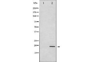 Western blot analysis of Cofilin phosphorylation expression in COLO205 whole cell lysates,The lane on the left is treated with the antigen-specific peptide.